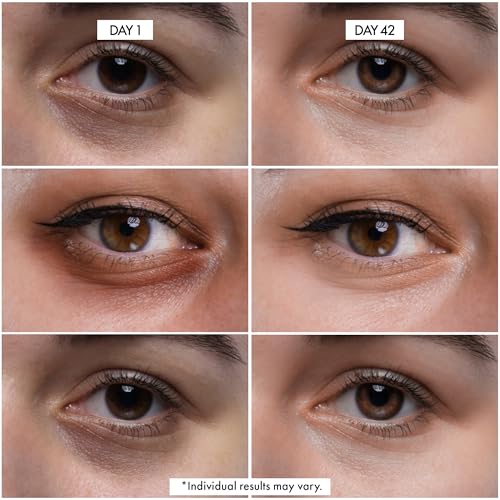 Dr Crazy Eye CPR Repairing Under Eye Cream for Dark Circles, Puffiness & Bags Under Eyes – Caffeine Serum for Wrinkles, Fine Lines – 30ml