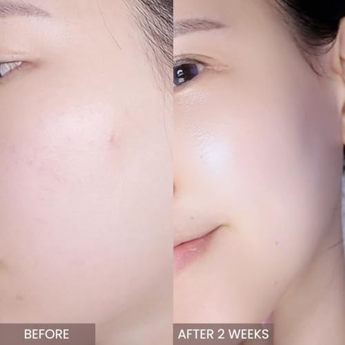 aplin Pink Tea Tree Intensive Cream